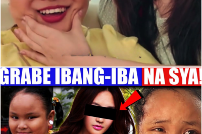 Grabe ang Pagbabago! Ito na Siya Ngayon—Halos Hindi na Makilala Matapos ang Matinding Pinagdaanan